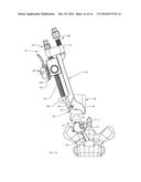 INSERTER AND METHOD FOR SECURING AN IMPLANT TO A SPINAL PROCESS WITH A     FLEXIBLE FASTENING SYSTEM diagram and image