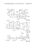 Combined Intramedullary and Extramedullary Surgical Aiming System And     Method diagram and image