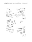 Combined Intramedullary and Extramedullary Surgical Aiming System And     Method diagram and image