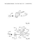Combined Intramedullary and Extramedullary Surgical Aiming System And     Method diagram and image