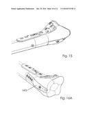 Combined Intramedullary and Extramedullary Surgical Aiming System And     Method diagram and image