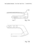 Combined Intramedullary and Extramedullary Surgical Aiming System And     Method diagram and image