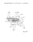 Combined Intramedullary and Extramedullary Surgical Aiming System And     Method diagram and image