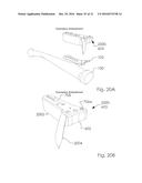 Combined Intramedullary and Extramedullary Surgical Aiming System And     Method diagram and image