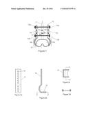 FRACTURE PLATING diagram and image