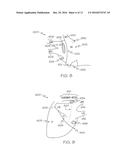 Ablation Device with Sensor diagram and image