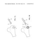 DELIVERY SYSTEM AND METHOD FOR DELIVERING MATERIAL TO A TARGET SITE DURING     A MEDICAL PROCEDURE diagram and image