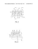 Self-Ligating Bracket diagram and image