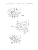 Self-Ligating Bracket diagram and image