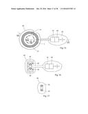 METHOD FOR CONTROLLING FLOW OF INTESTINAL CONTENTS IN A PATIENT S     INTESTINES diagram and image