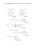 METHOD FOR CONTROLLING FLOW OF INTESTINAL CONTENTS IN A PATIENT S     INTESTINES diagram and image