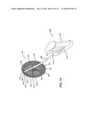 Skirted Tissue Repair Implant Having Position Indication Feature diagram and image