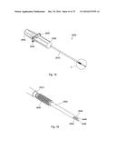 MULTIPLE IMPLANT CONSTRUCTIONS AND FIXATION METHODS ASSOCIATED THEREWITH diagram and image