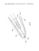 MULTIPLE IMPLANT CONSTRUCTIONS AND FIXATION METHODS ASSOCIATED THEREWITH diagram and image