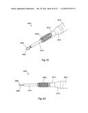 MULTIPLE IMPLANT CONSTRUCTIONS AND FIXATION METHODS ASSOCIATED THEREWITH diagram and image