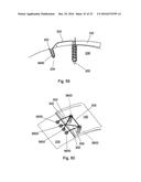 MULTIPLE IMPLANT CONSTRUCTIONS AND FIXATION METHODS ASSOCIATED THEREWITH diagram and image