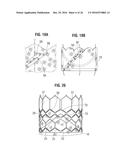 PROSTHETIC HEART VALVE diagram and image