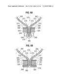 PROSTHETIC HEART VALVE diagram and image