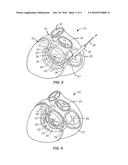 TISSUE SHAPING DEVICE diagram and image