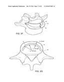 IN-SITU FORMED INTERVERTEBRAL FUSION DEVICE AND METHOD diagram and image