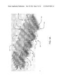 COMPOSITE SPINAL FACET IMPLANT WITH TEXTURED SURFACES diagram and image