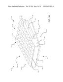 COMPOSITE SPINAL FACET IMPLANT WITH TEXTURED SURFACES diagram and image