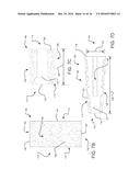 COMPOSITE SPINAL FACET IMPLANT WITH TEXTURED SURFACES diagram and image