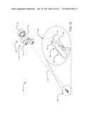 COMPOSITE SPINAL FACET IMPLANT WITH TEXTURED SURFACES diagram and image