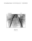 Crush Recoverable Polymer Scaffolds diagram and image