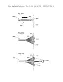 METHODS AND INSTRUMENTS FOR TREATING OBESITY diagram and image