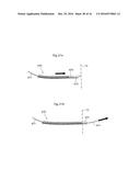 METHODS AND INSTRUMENTS FOR TREATING OBESITY diagram and image