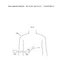 METHODS AND INSTRUMENTS FOR TREATING OBESITY diagram and image