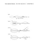 METHODS AND INSTRUMENTS FOR TREATING OBESITY diagram and image