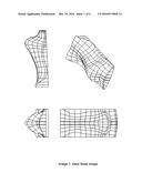 Rhinoplasty Cotrol Molds (transverse, Axial, Basal, Final, Final Splint) diagram and image