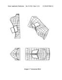 Rhinoplasty Cotrol Molds (transverse, Axial, Basal, Final, Final Splint) diagram and image