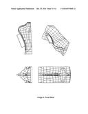 Rhinoplasty Cotrol Molds (transverse, Axial, Basal, Final, Final Splint) diagram and image