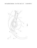 OPHTHALMIC SURGICAL DEVICE FOR ACCESSING TISSUE AND FOR PERFORMING A     CAPSULOTOMY diagram and image