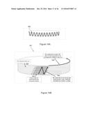 COMPACT ULTRA-SHORT PULSED LASER EYE SURGERY WORKSTATION diagram and image