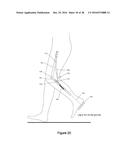 Design and Use of a Leg Support Exoskeleton diagram and image