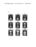 Method of Treatment of Alopecia with Monoterpenoids diagram and image