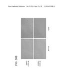 SHP2 INHIBITORS AND METHODS OF TREATING AUTOIMMUNE AND/OR     GLOMERULONEPHRITIS-ASSOCIATED DISEASES USING SHP2 INHIBITORS diagram and image