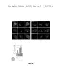 USE OF NOVEL AUTOPHAGY INHIBITORS TO TREAT AUTOPHAGY RELATED HUMAN     DISEASES diagram and image