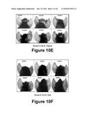 Herbal Combinations for Treating Eczema diagram and image