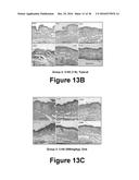 Herbal Combinations for Treating Eczema diagram and image