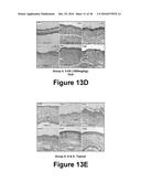 Herbal Combinations for Treating Eczema diagram and image