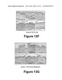 Herbal Combinations for Treating Eczema diagram and image