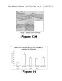 Herbal Combinations for Treating Eczema diagram and image