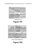 Herbal Combinations for Treating Eczema diagram and image