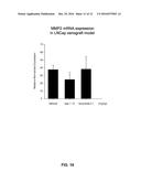 Composition for Treating Prostate Cancer diagram and image