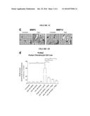 COMPOSITIONS AND METHODS TO TREAT INFLAMMATORY JOINT DISEASE diagram and image